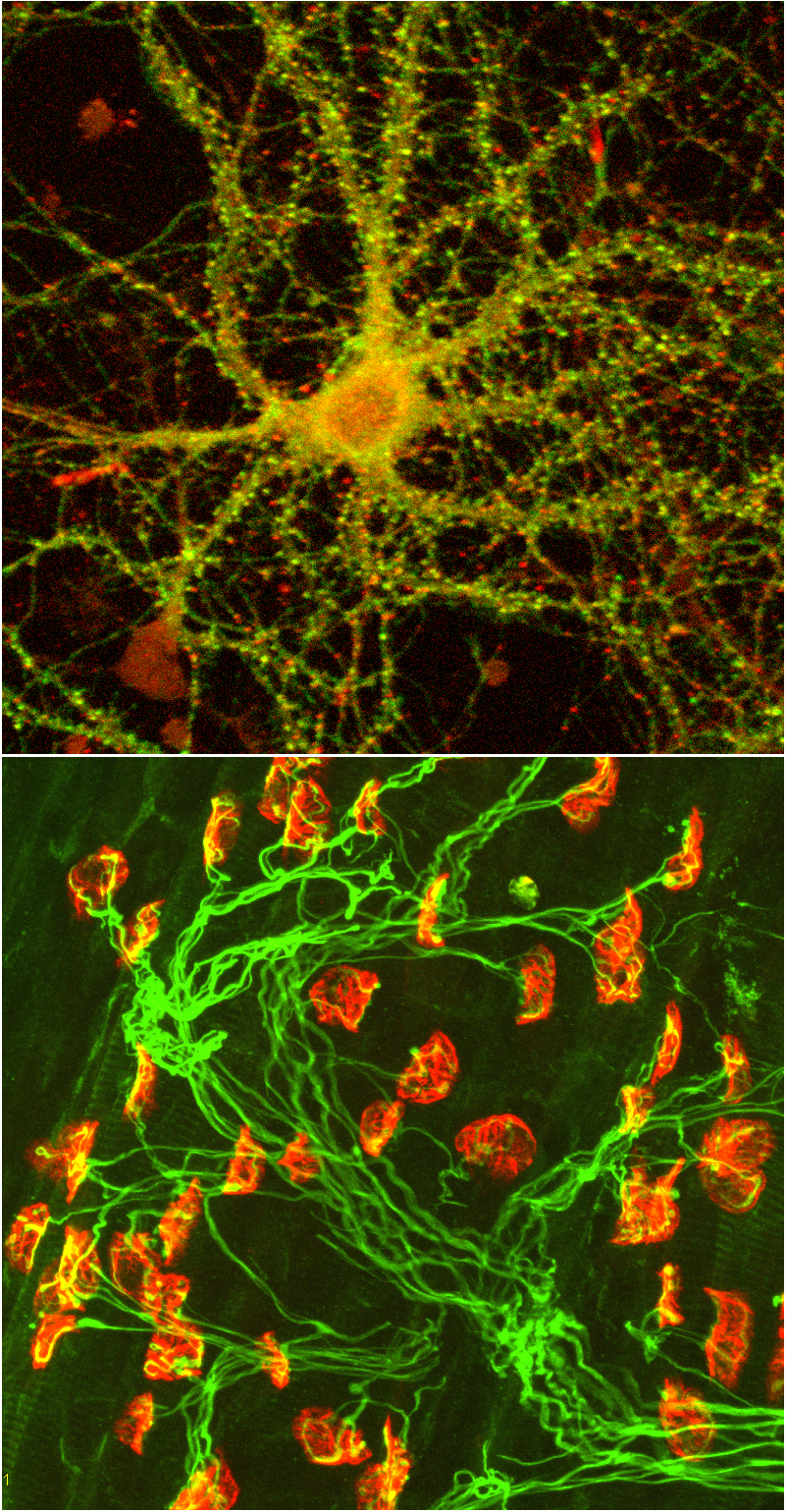 EphA4-mediated signaling is important for neural plasticity