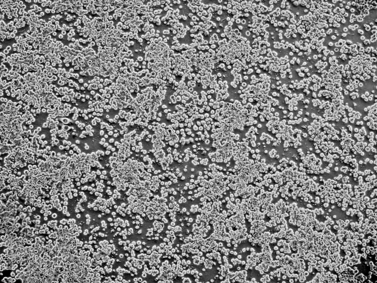 Insect cells used for developing HEV vaccine