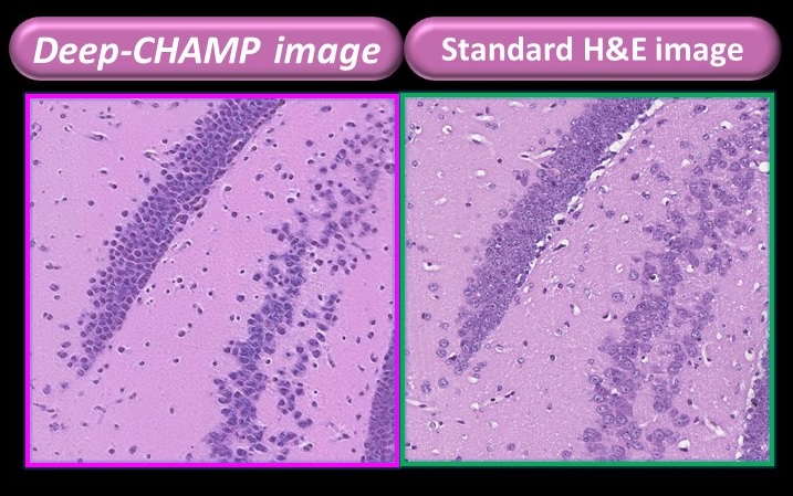 Comparison of the tissue images presented by the microscope developed by PhoMedics and the FFPE tissue